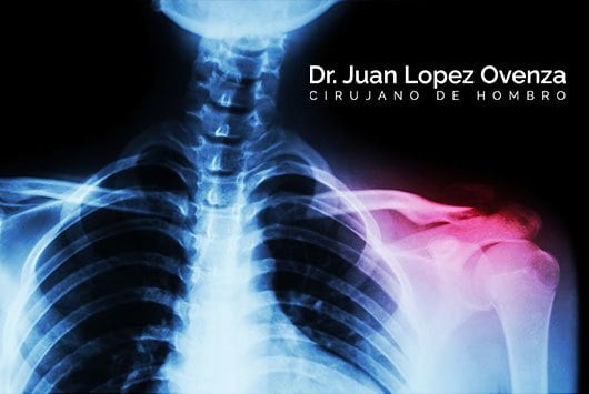 cirugía artroscopia